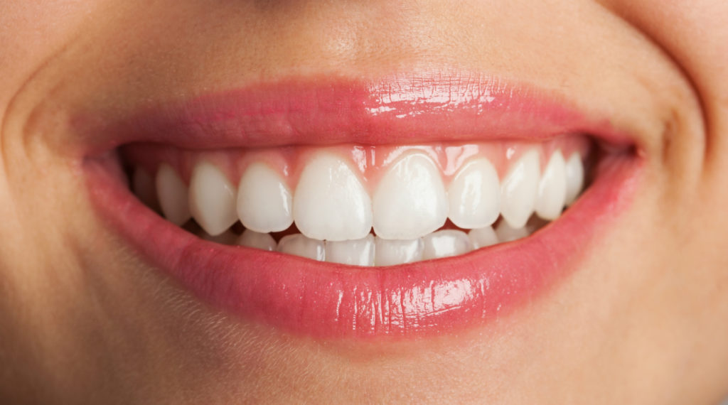Sekutic Tooth whitening
